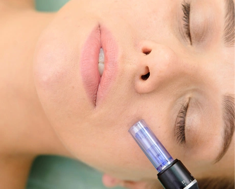 Microneedling