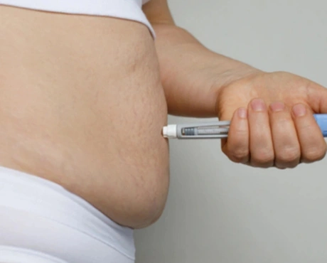 Weight Loss